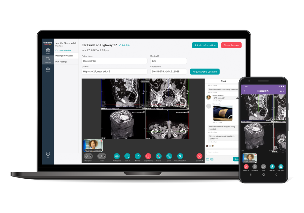 laptop and android phone with screen sharing of a cat scan